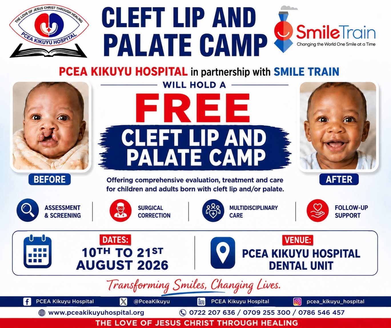 PCEA Kikuyu Hospital Free Cleft Lip and Palate Camp