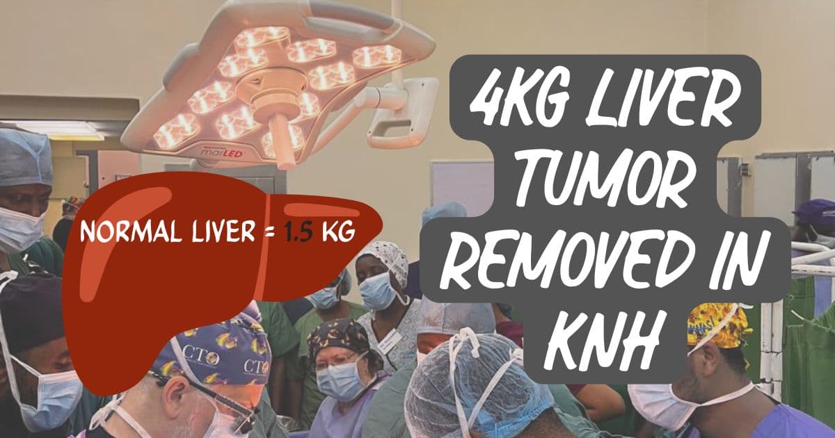 7 Hours Later: Removing a 4kg Liver Tumour at a KNH Surgical Camp